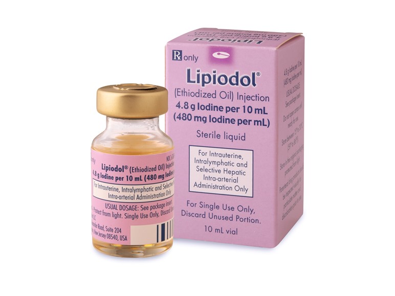 Lipiodol® – Innowacyjne leczenie niepłodności
